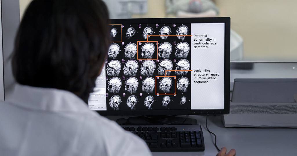 AI Healthcare Solutions with Data Annotation